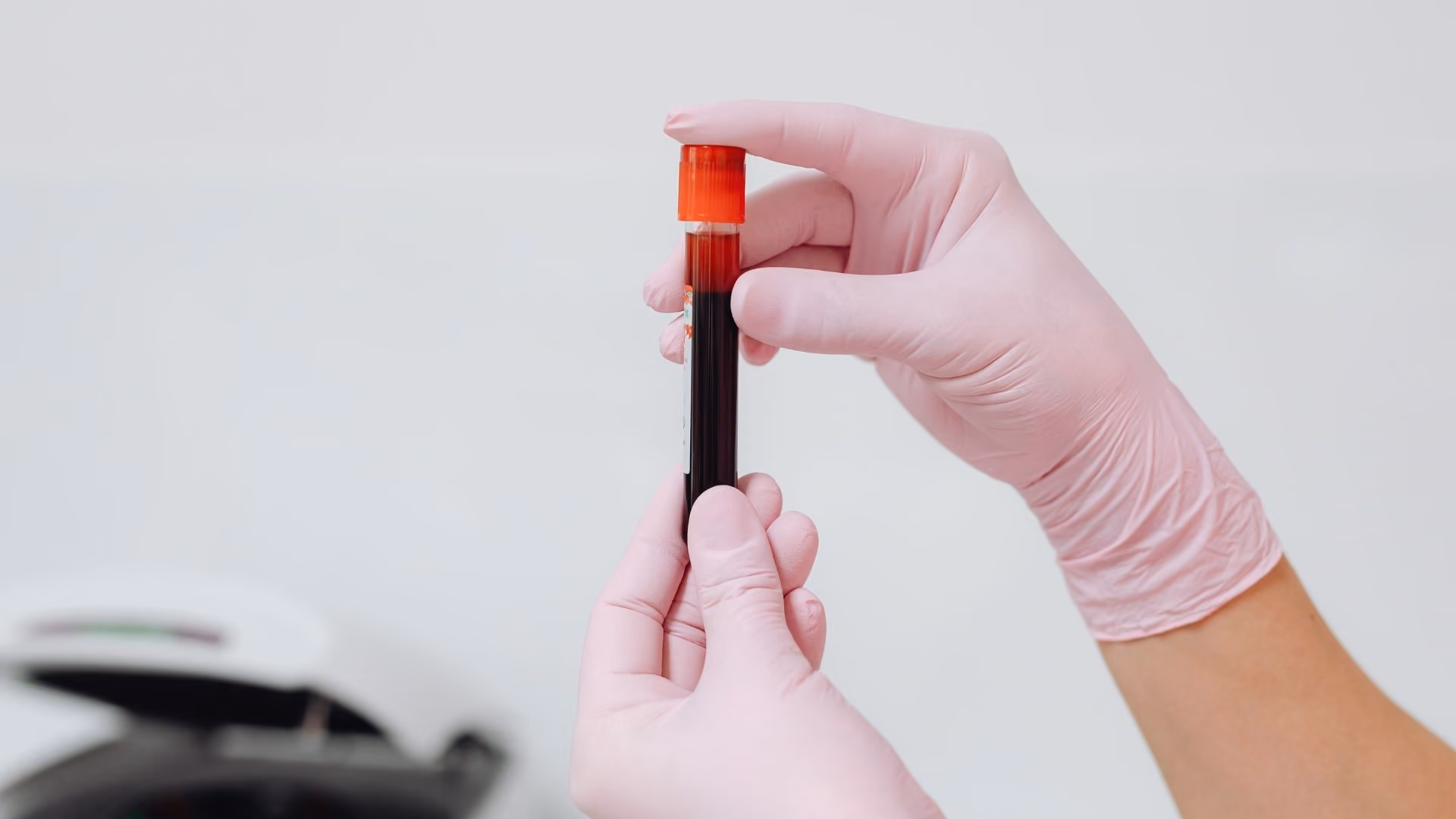 A person holds a test tube full of blood