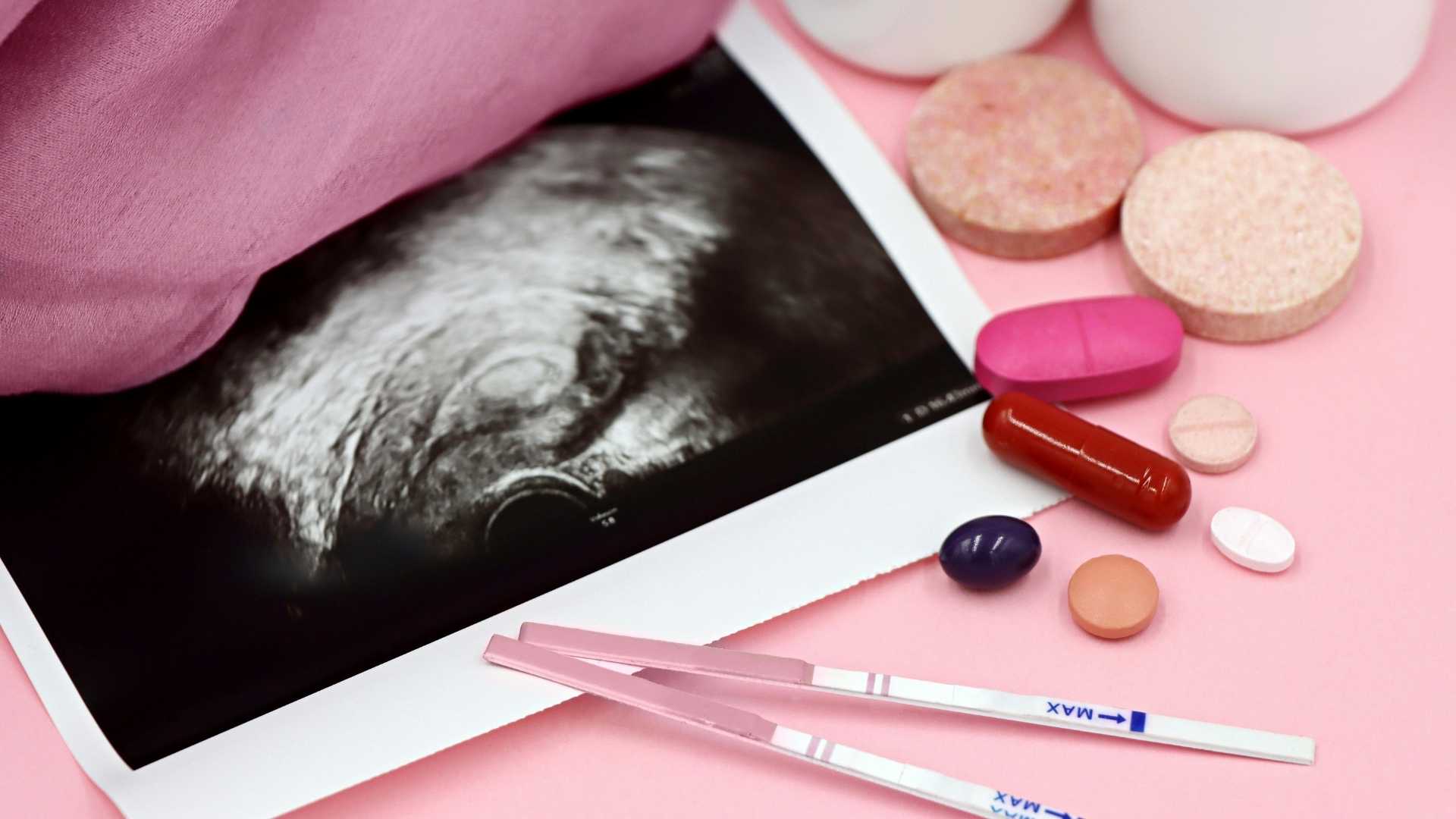 A pregnancy scan, pregnancy tests, and pills