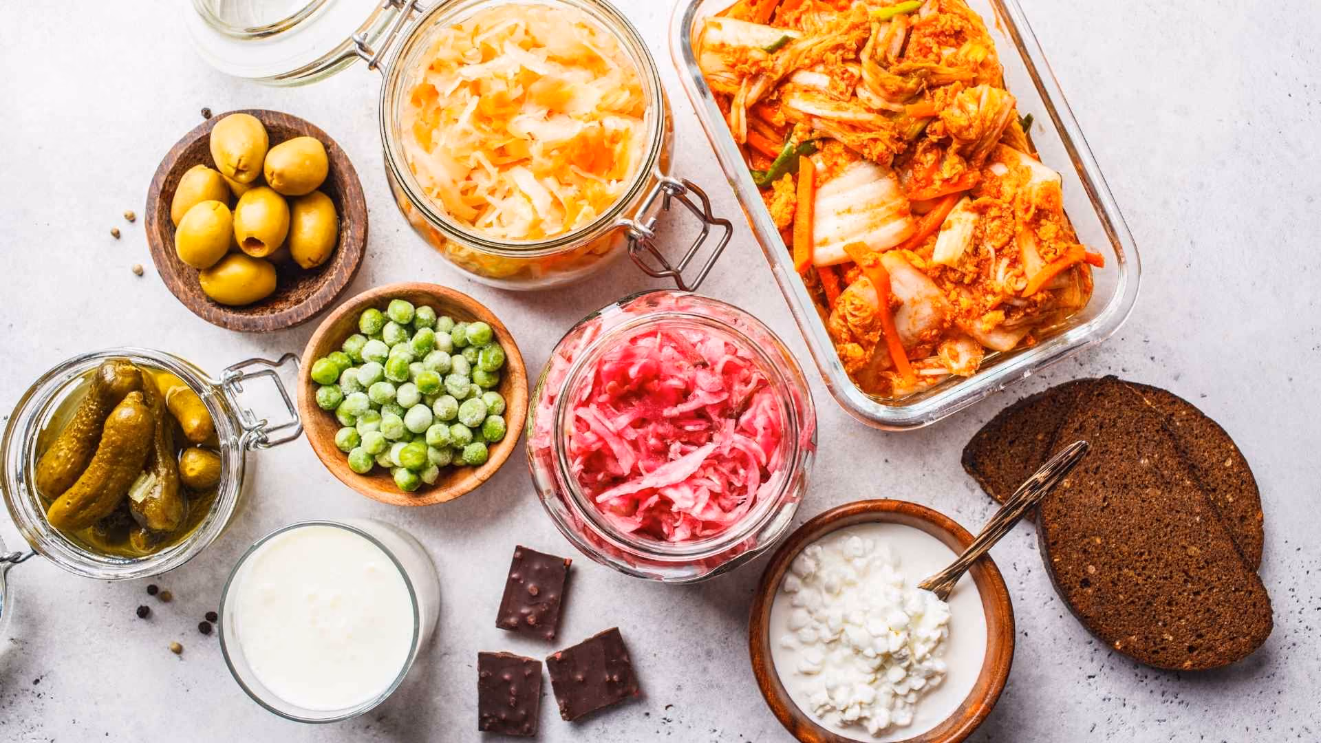 An array of fermented foods