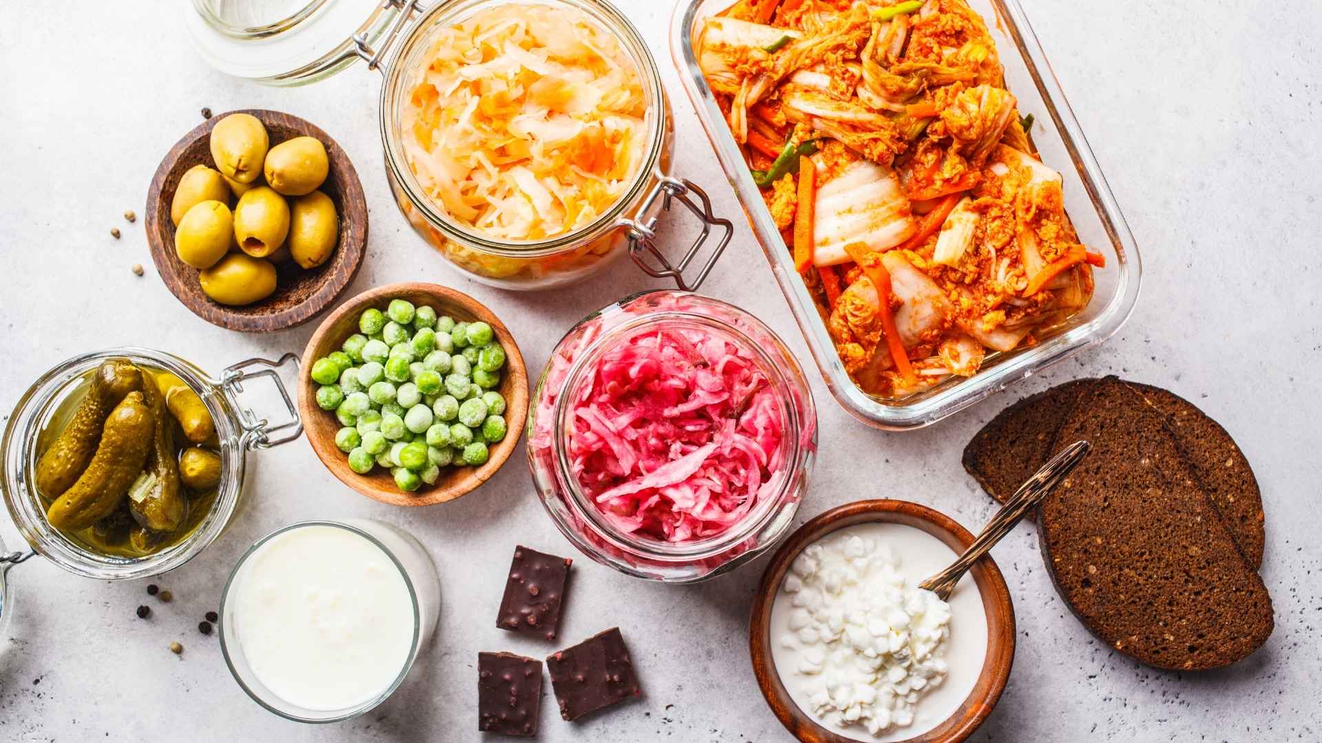 An array of fermented foods