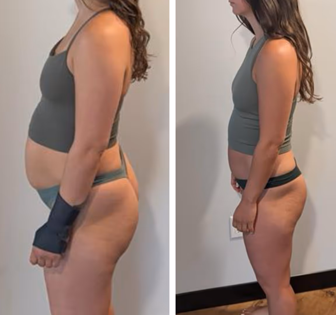 Side-by-side images of one woman showing her body weight loss.