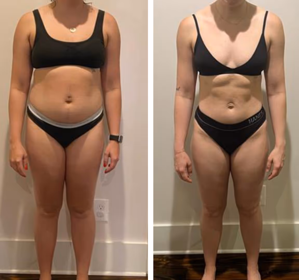 Side-by-side images of one woman showing her body weight loss.
