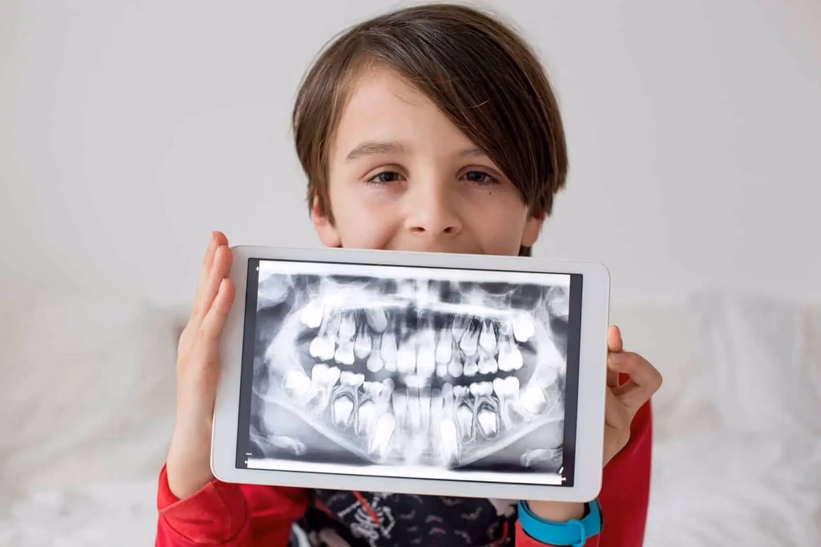 Dental X-rays