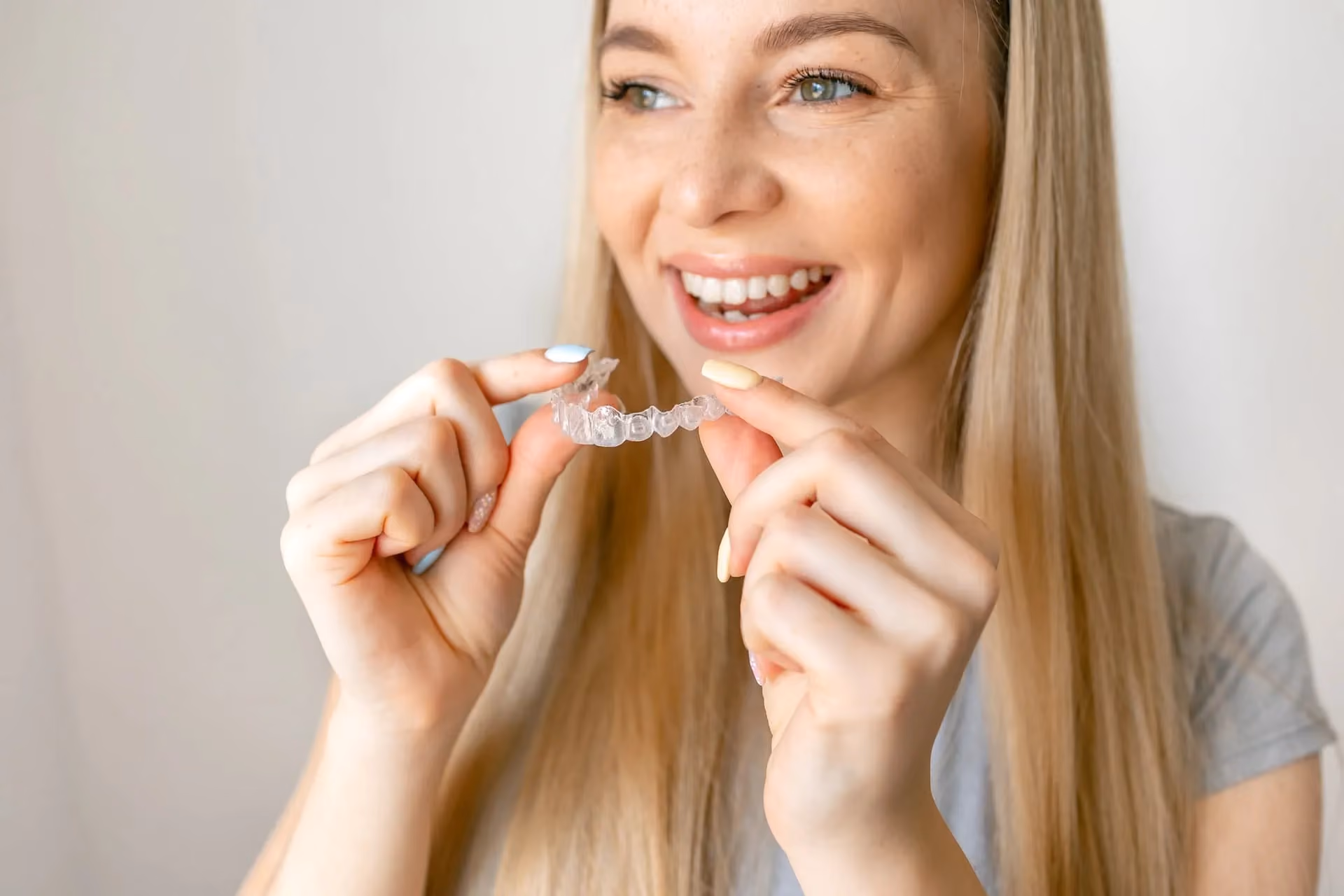Clear Aligners