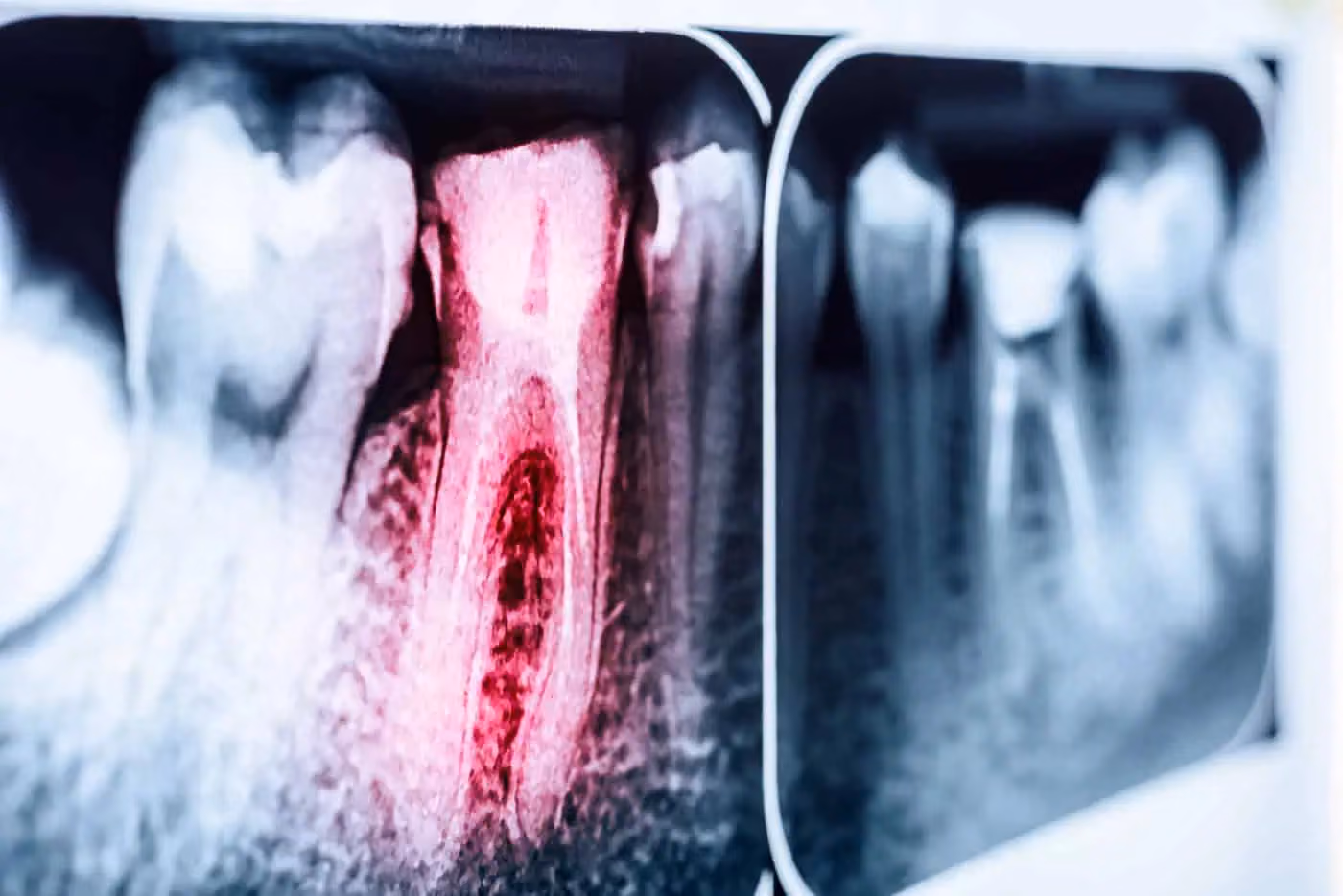Endodontics