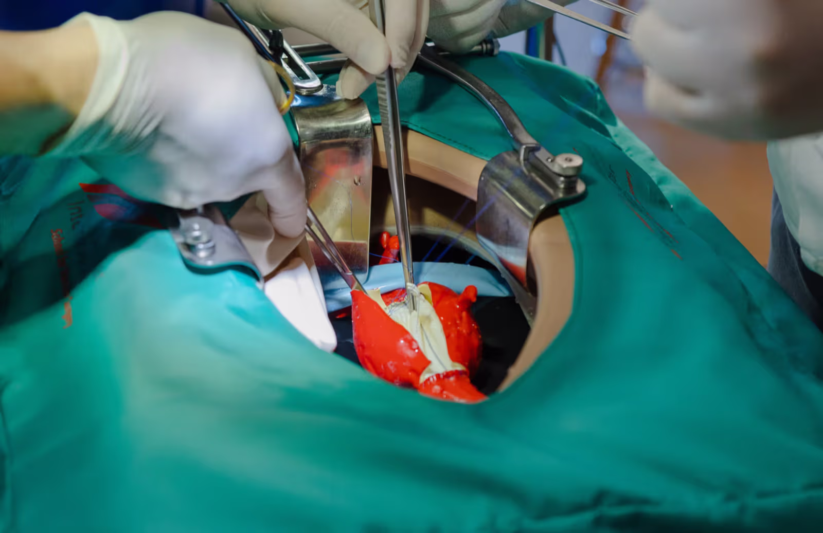 Offene Bauchaortenchirurgie (Rohrprothesen-Implantation) am pulsatilen Simulator (13:00-15:00)