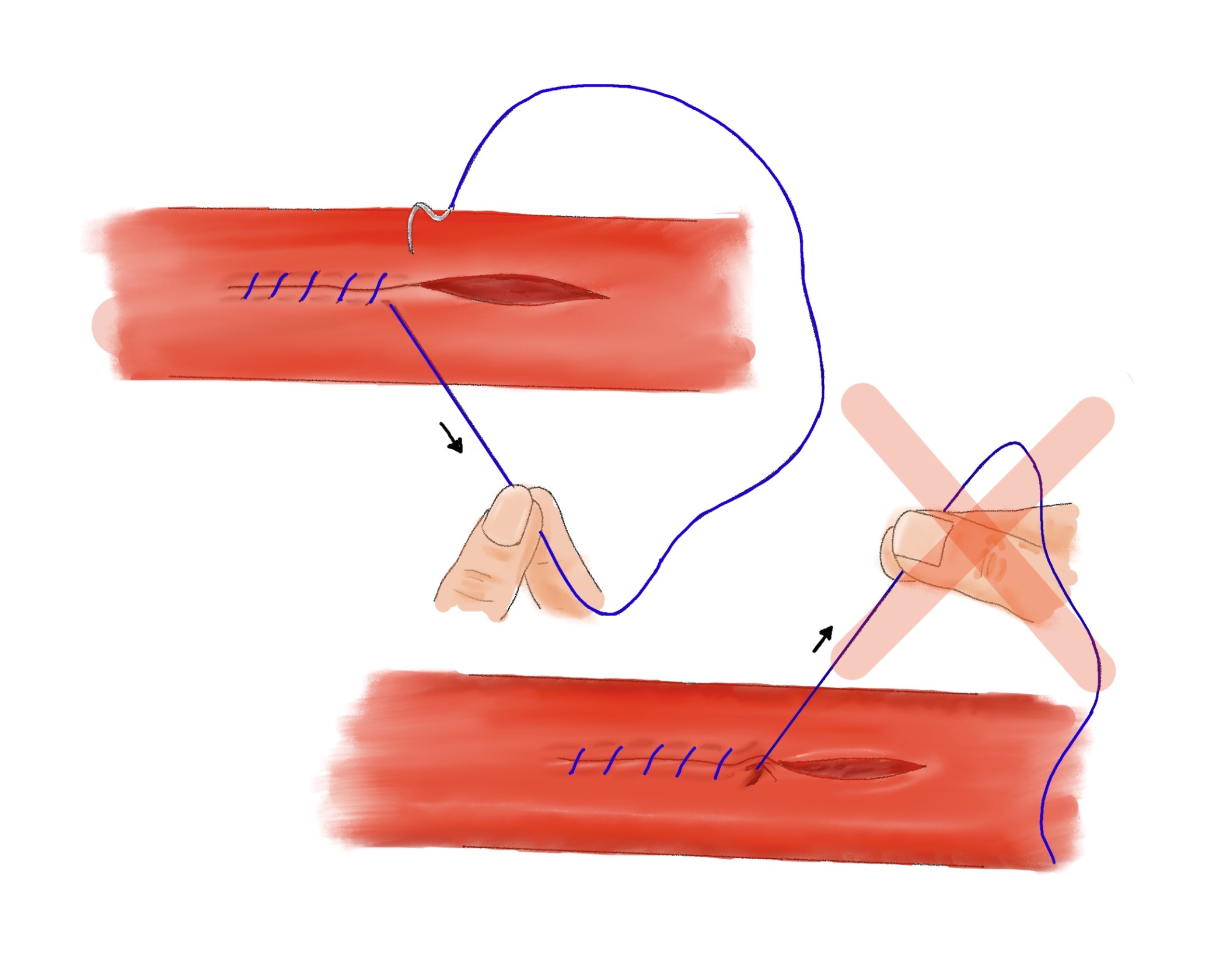Pull thread in direction of stitch