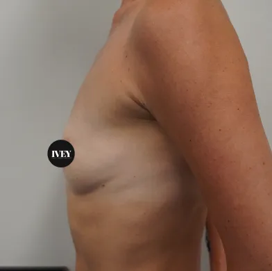 Side view of a bare torso and arm against a plain wall with a small circular black label covering the nipple area.