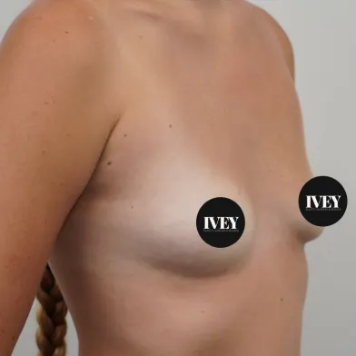 Close-up of a woman's upper torso and shoulder with skin tone variations and long braided hair.