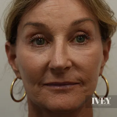 Close-up portrait of a middle-aged woman with light brown hair, green eyes, and gold hoop earrings against a plain background.
