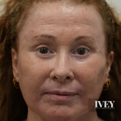 Close-up of a middle-aged woman with light brown skin and curly hair wearing small gold hoop earrings, looking directly at the camera with a neutral expression, with a logo in the bottom right corner.