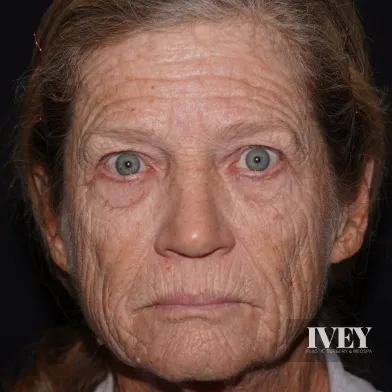 Close-up of an elderly woman with deep facial wrinkles and gray eyes against a dark background.