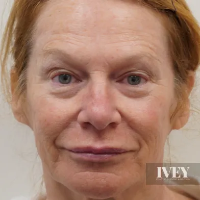 Close-up portrait of a middle-aged woman with light skin, reddish hair, and green eyes, against a plain background.