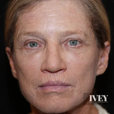 Close-up portrait of an older woman with light eyes, wrinkles, and short light brown hair against a dark background.