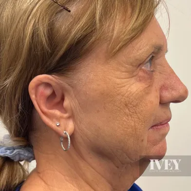 Profile view of an older woman with light brown hair tied back, wearing silver hoop and stud earrings.