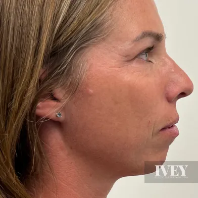 Profile view of a middle-aged woman with light brown hair and a diamond stud earring against a plain background.