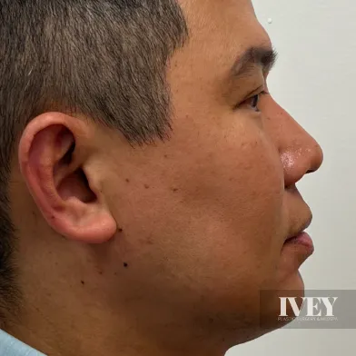 Close-up side profile of a man with short hair against a plain light background.