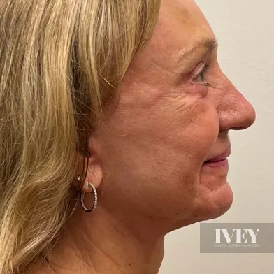 Profile view of an older woman with blonde hair, wearing a silver hoop earring, against a plain light background.