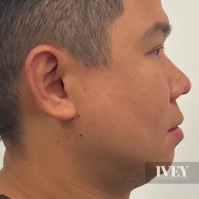 Side profile of a man's face with short hair against a plain background.