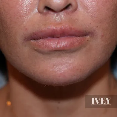 Close-up of a person's lower face showing natural lips, skin texture, and part of the chin.