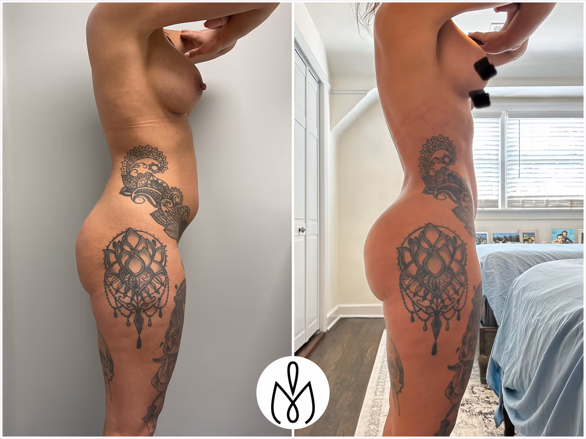 Before,After
