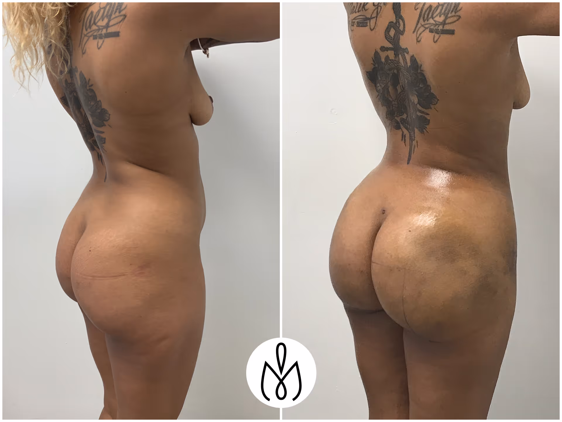 Before,After
