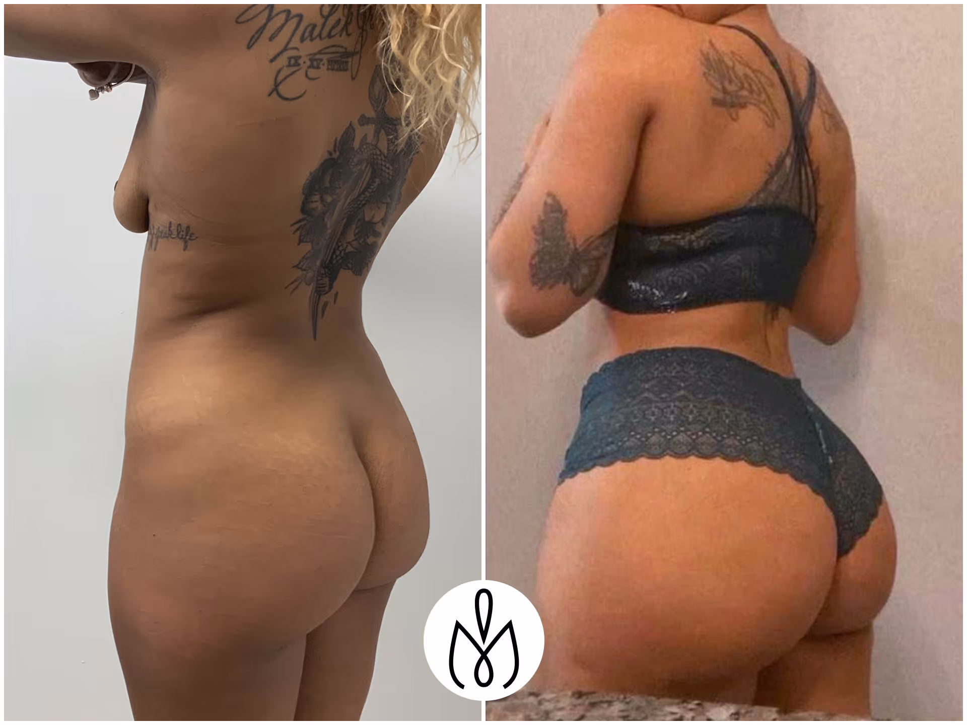 Before,After