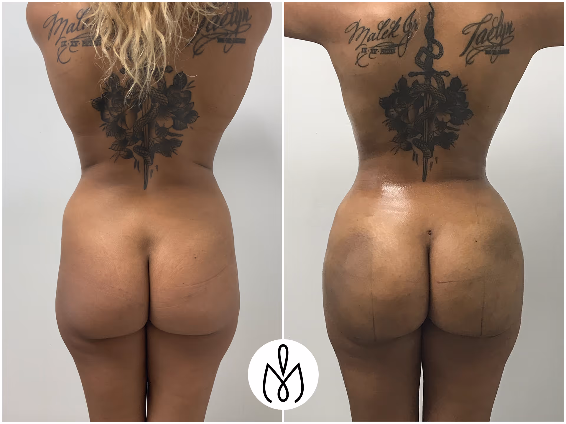 Before,After