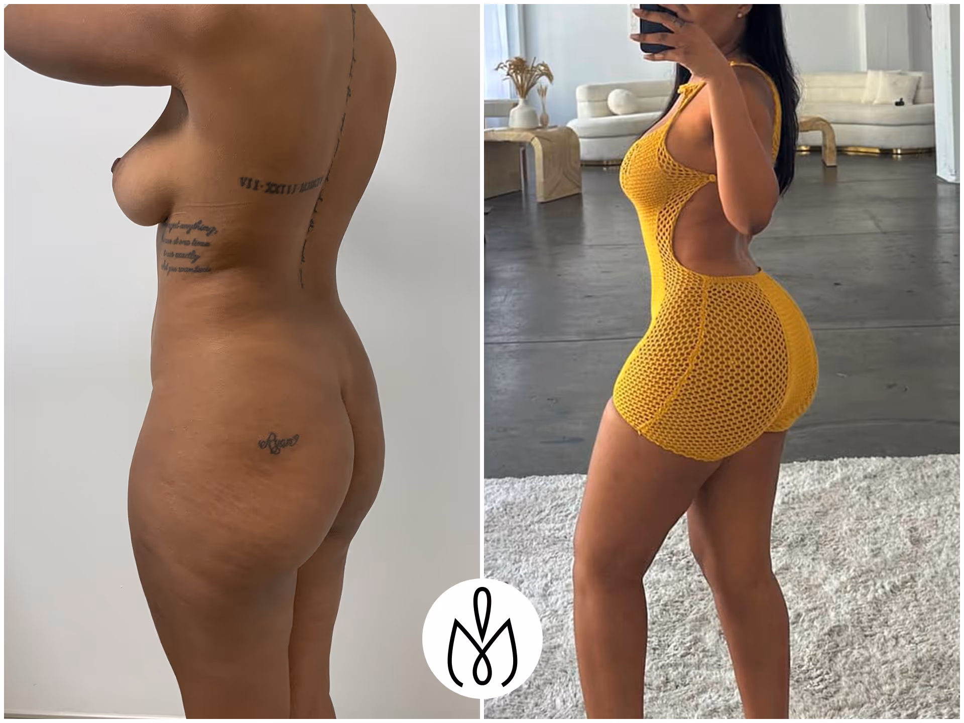 Before,After
