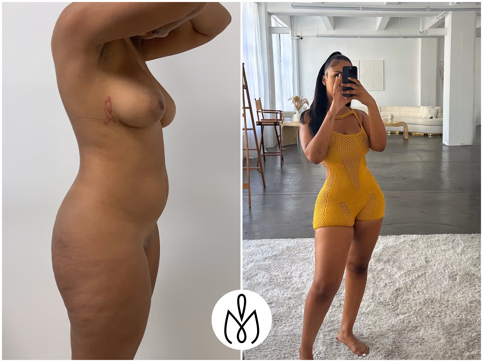 Before,After