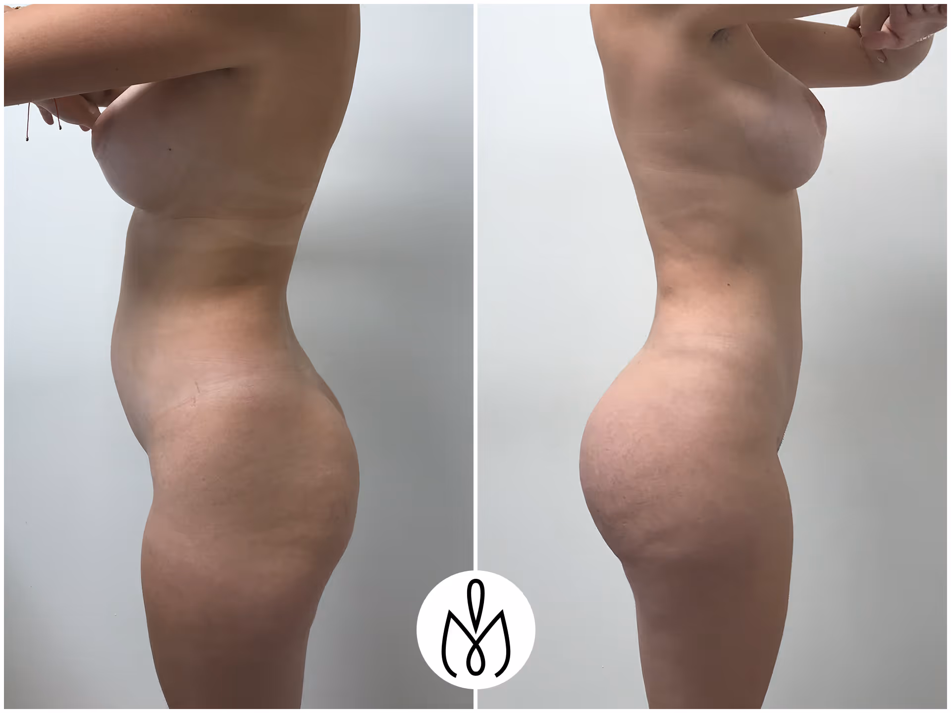 Before,After