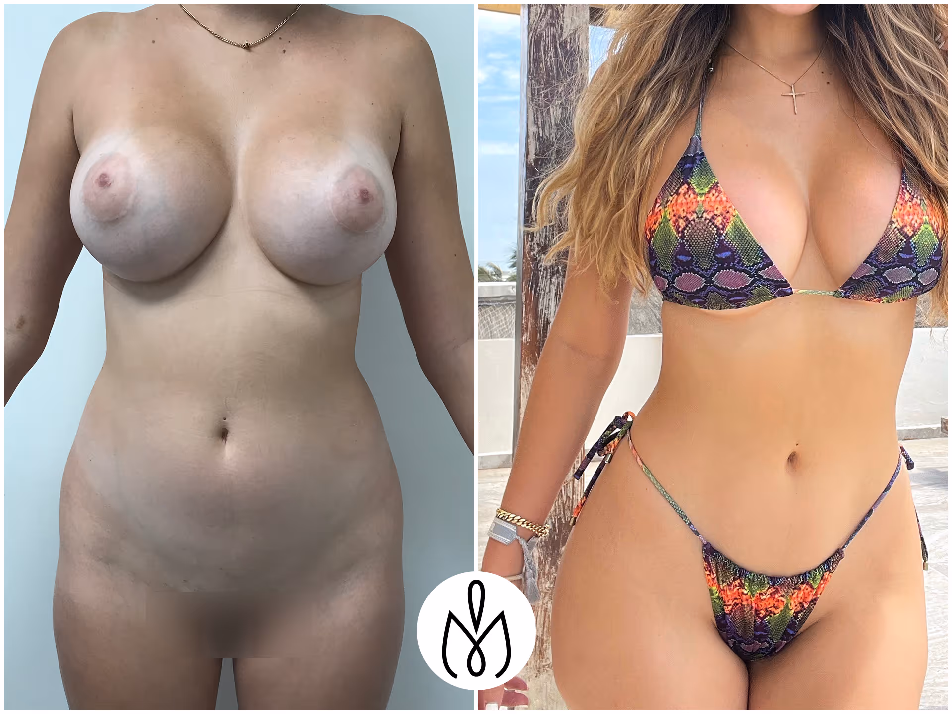 Before,After