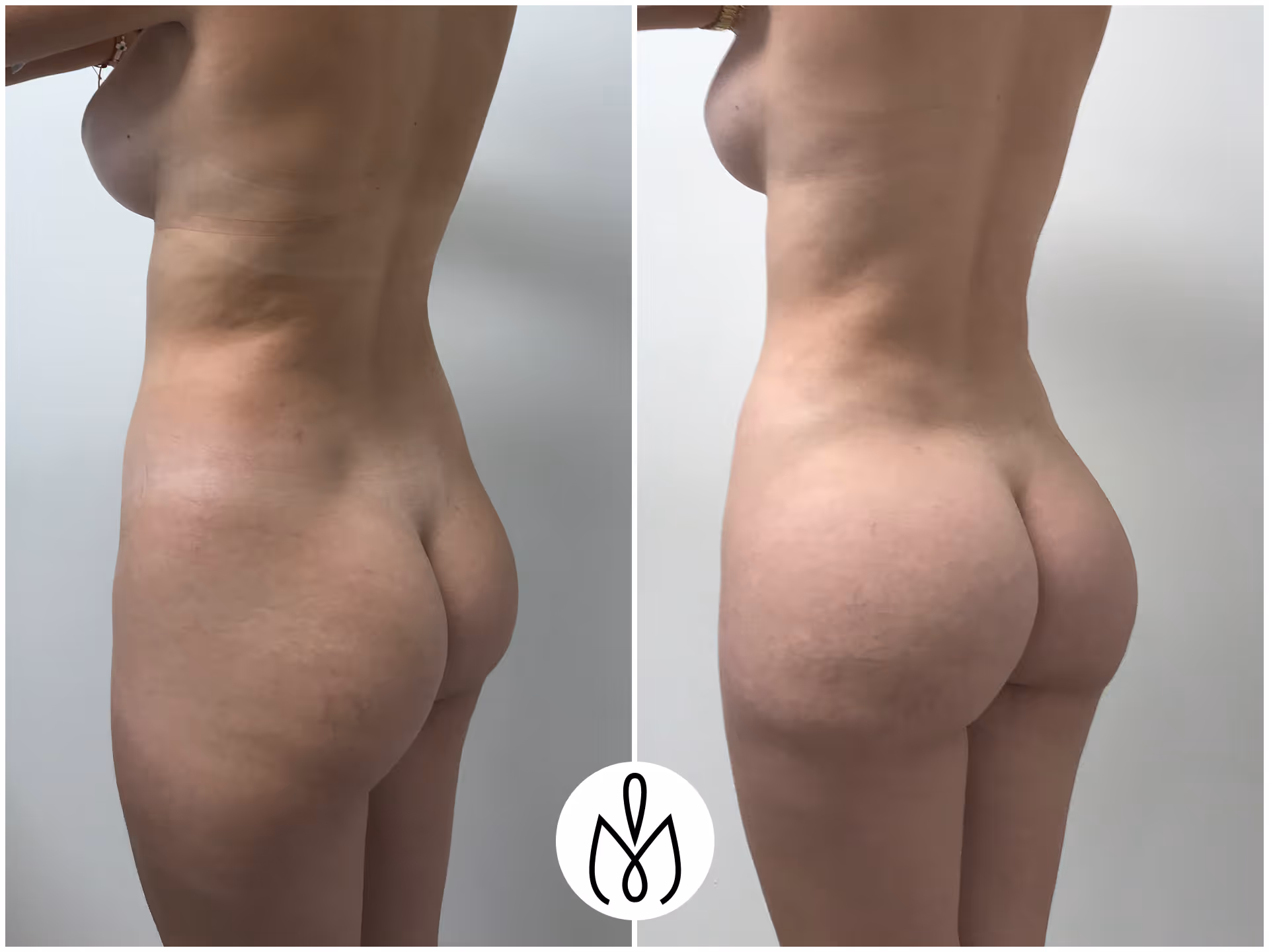 Before,After