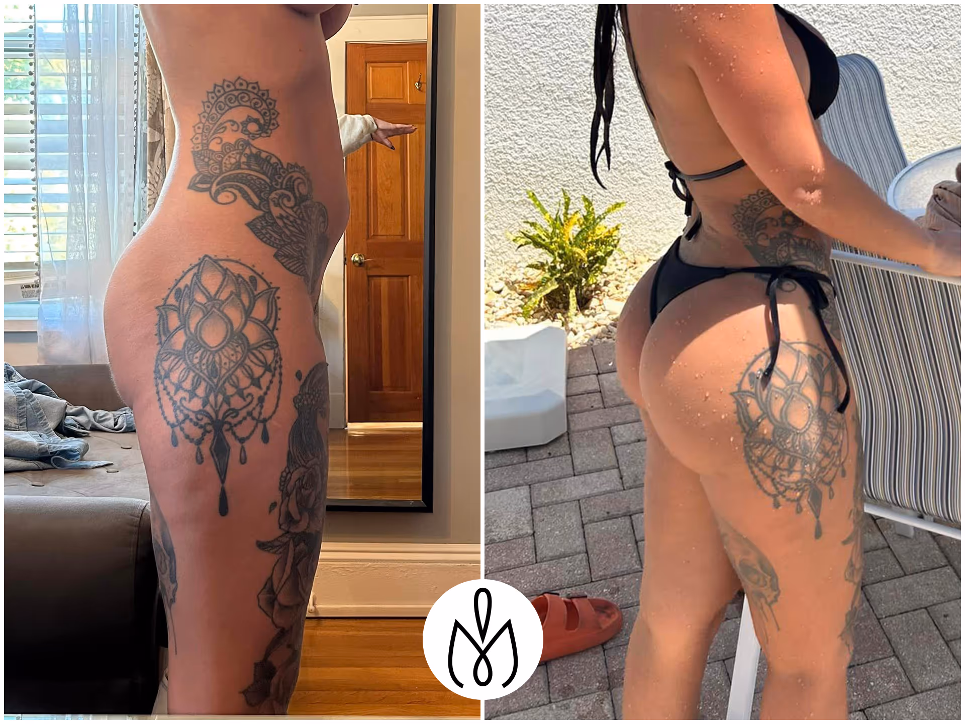 Before,After