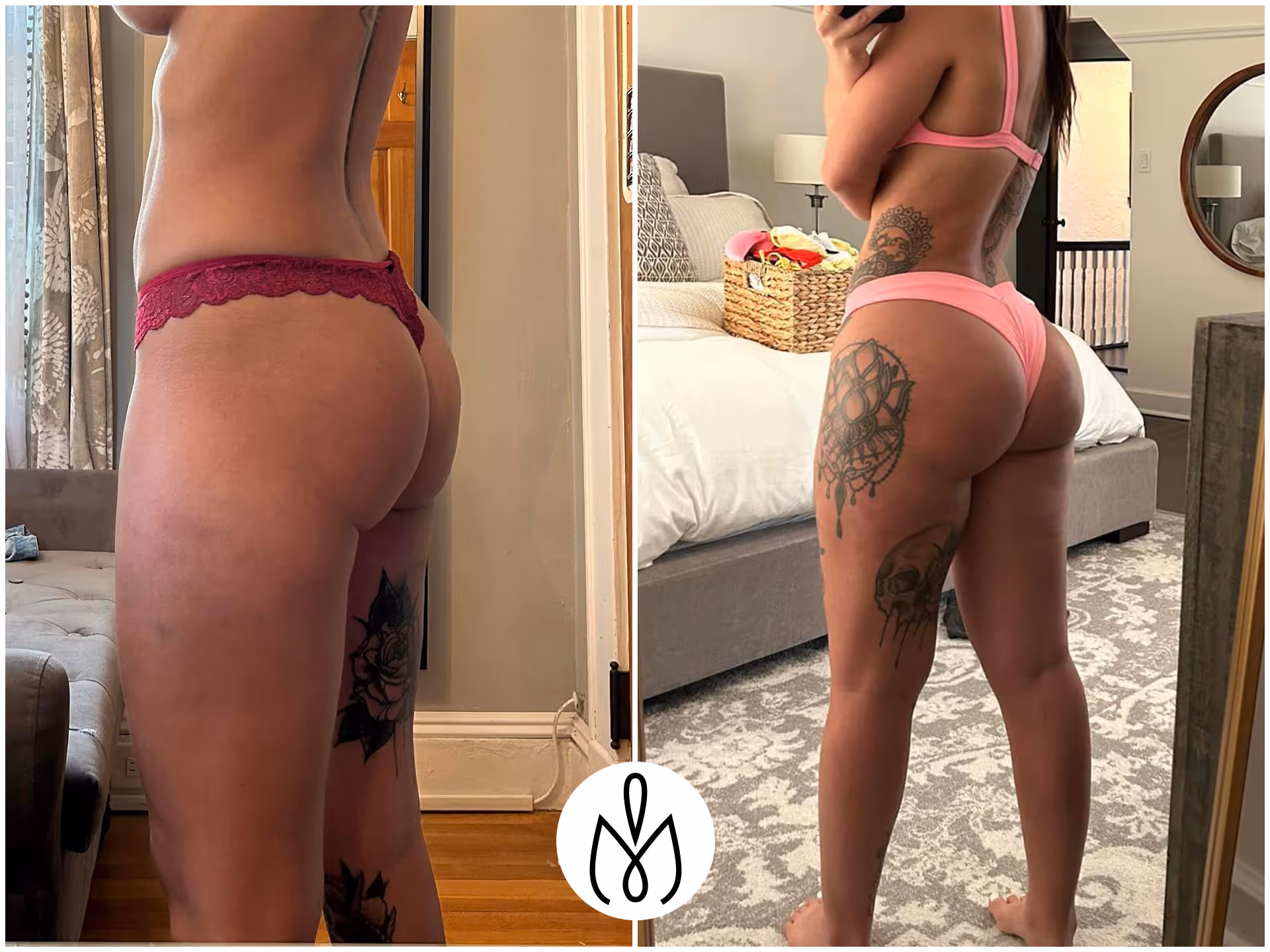 Before,After