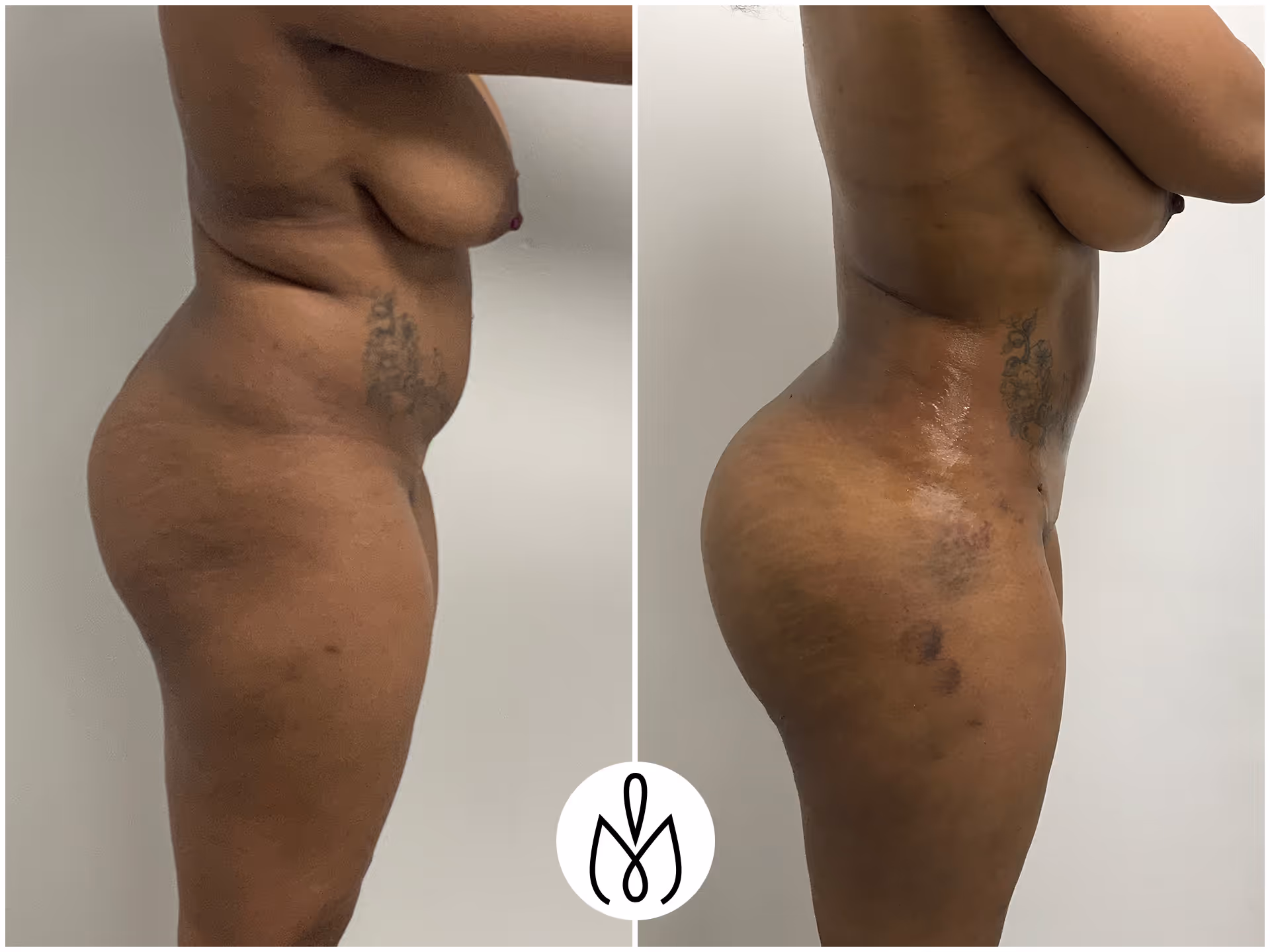 Before,After