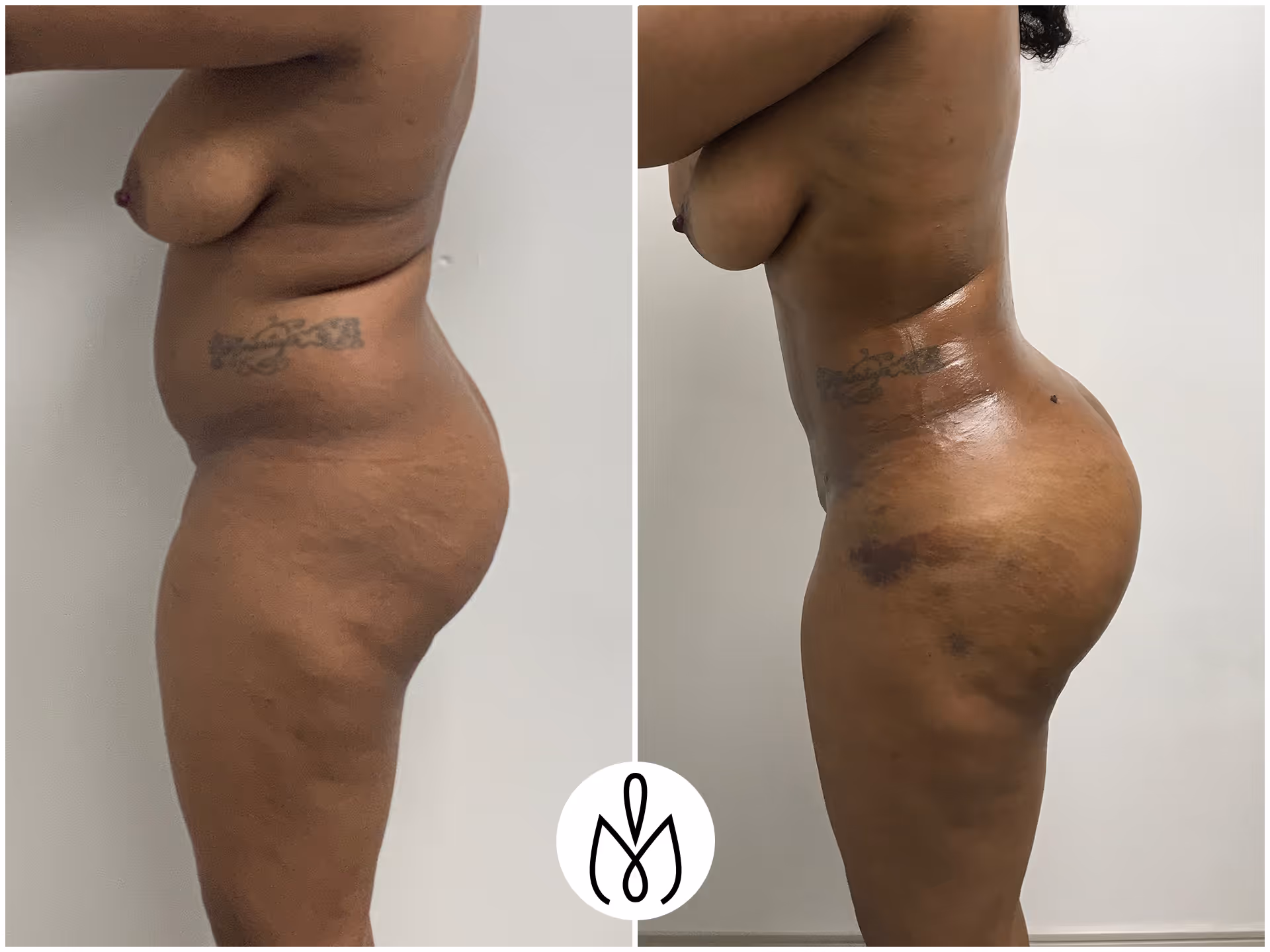 Before,After