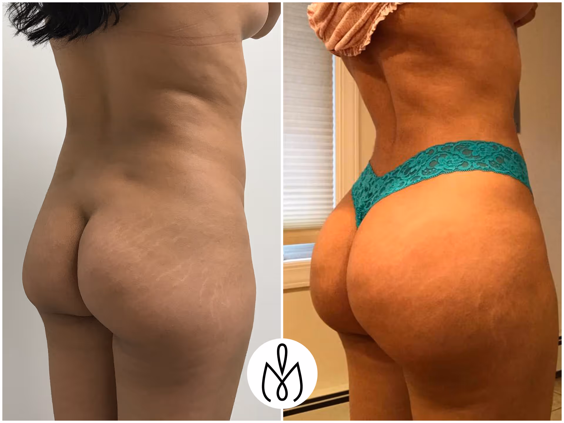Before,After