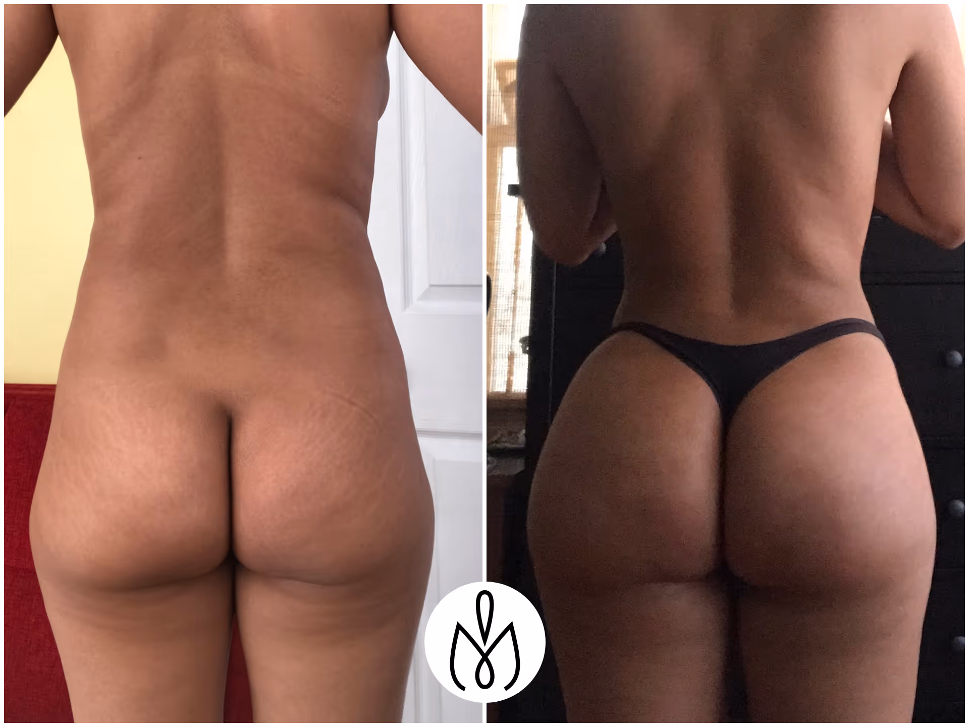Before,After