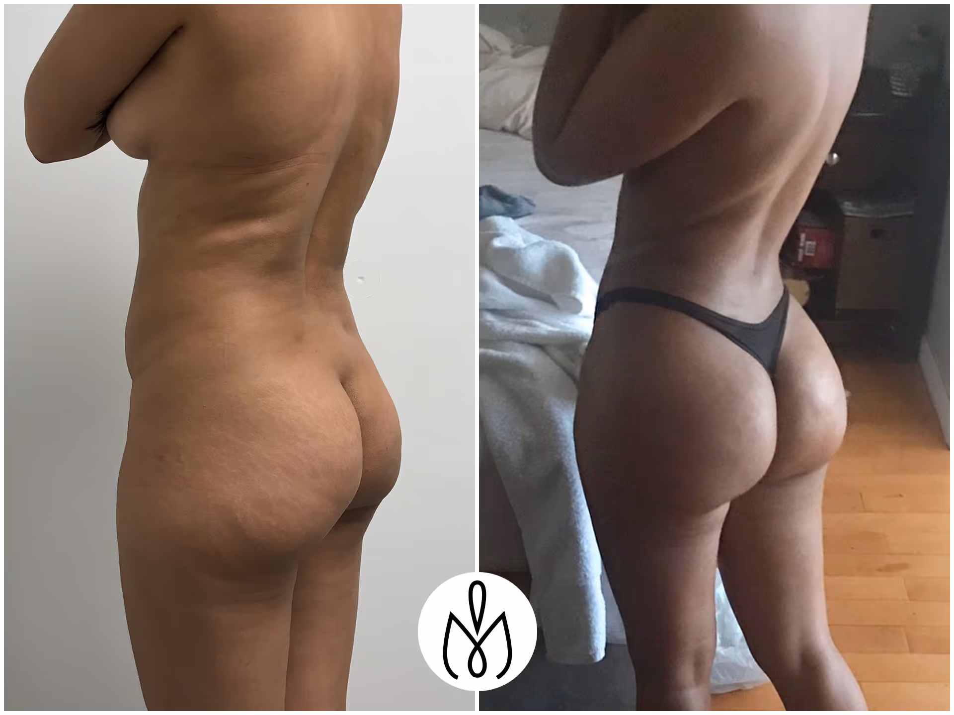 Before,After