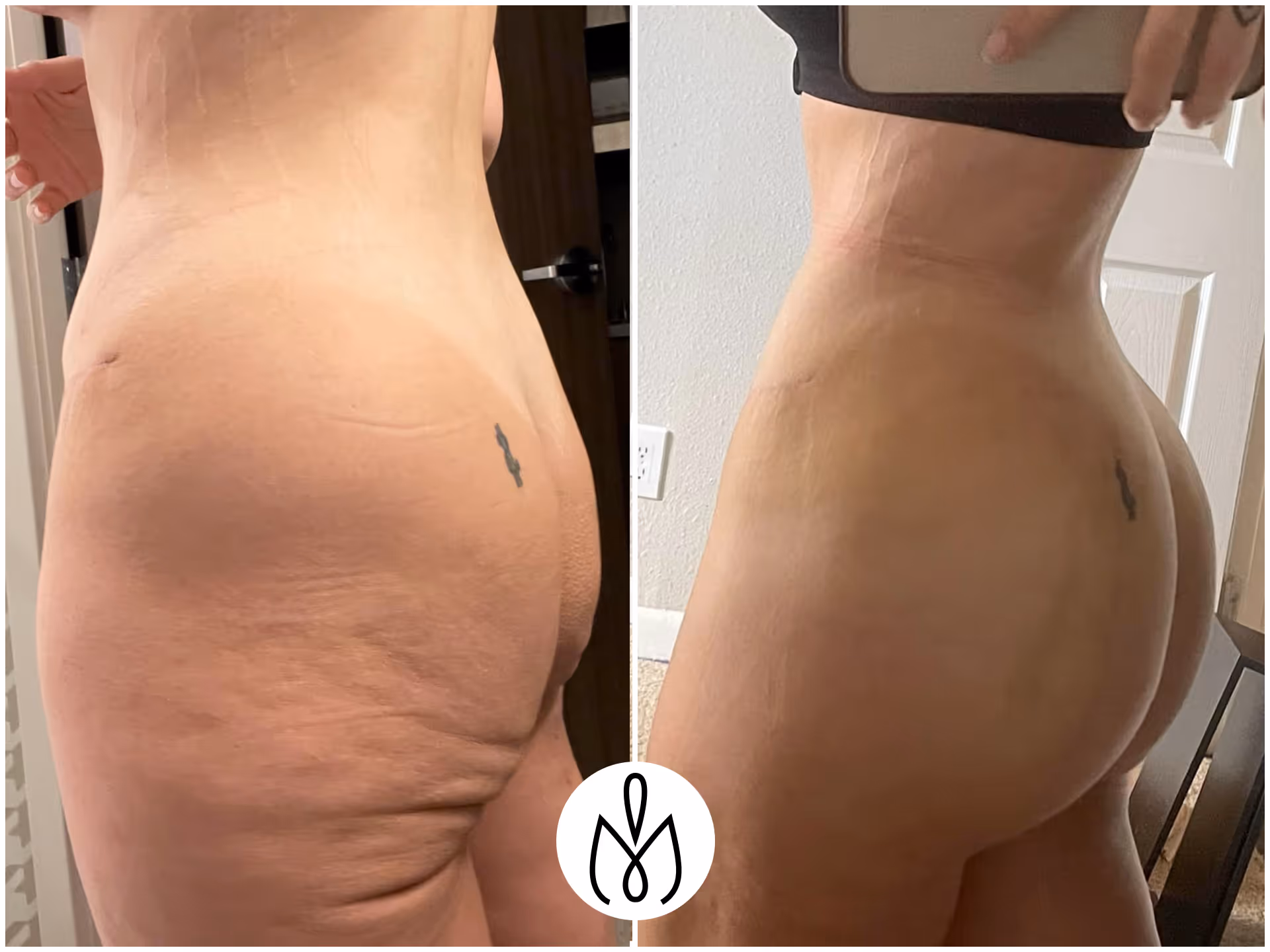 Before,After