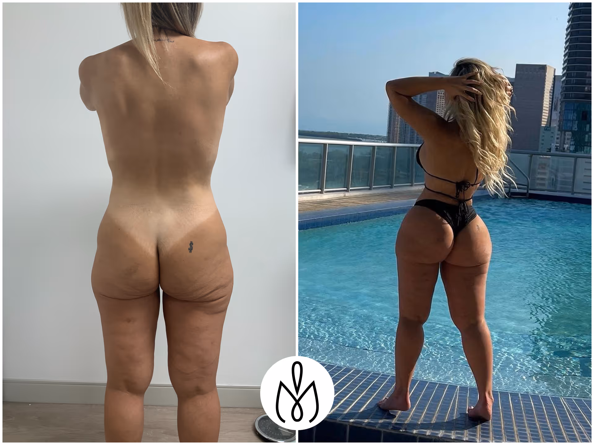 Before,After