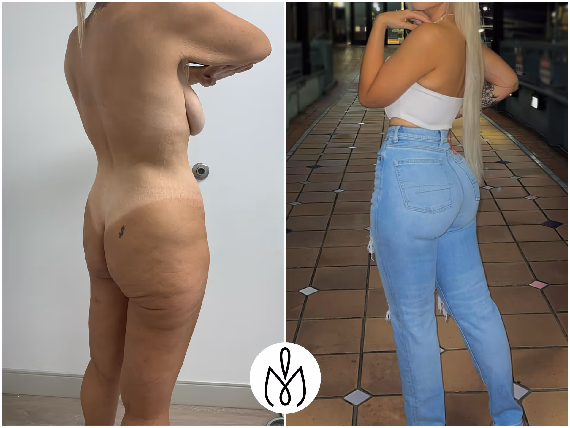Before,After