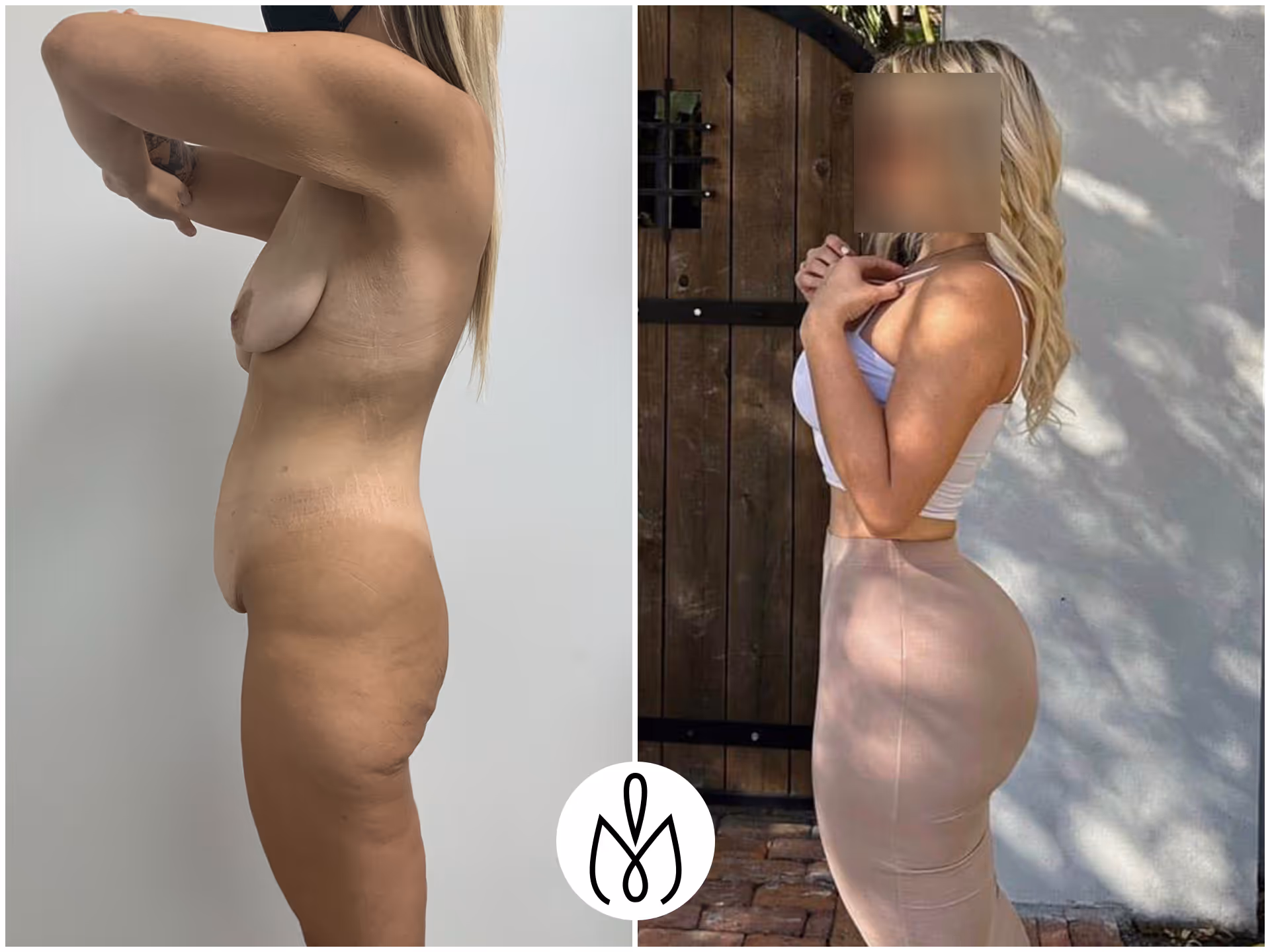 Before,After