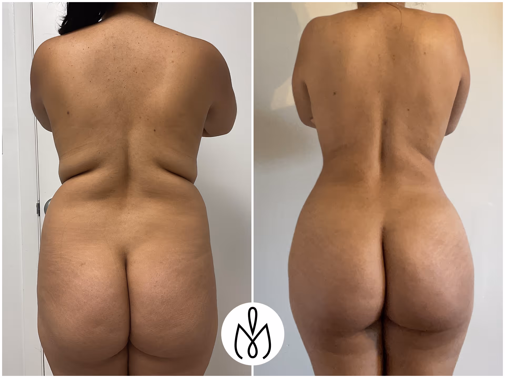 Before,After