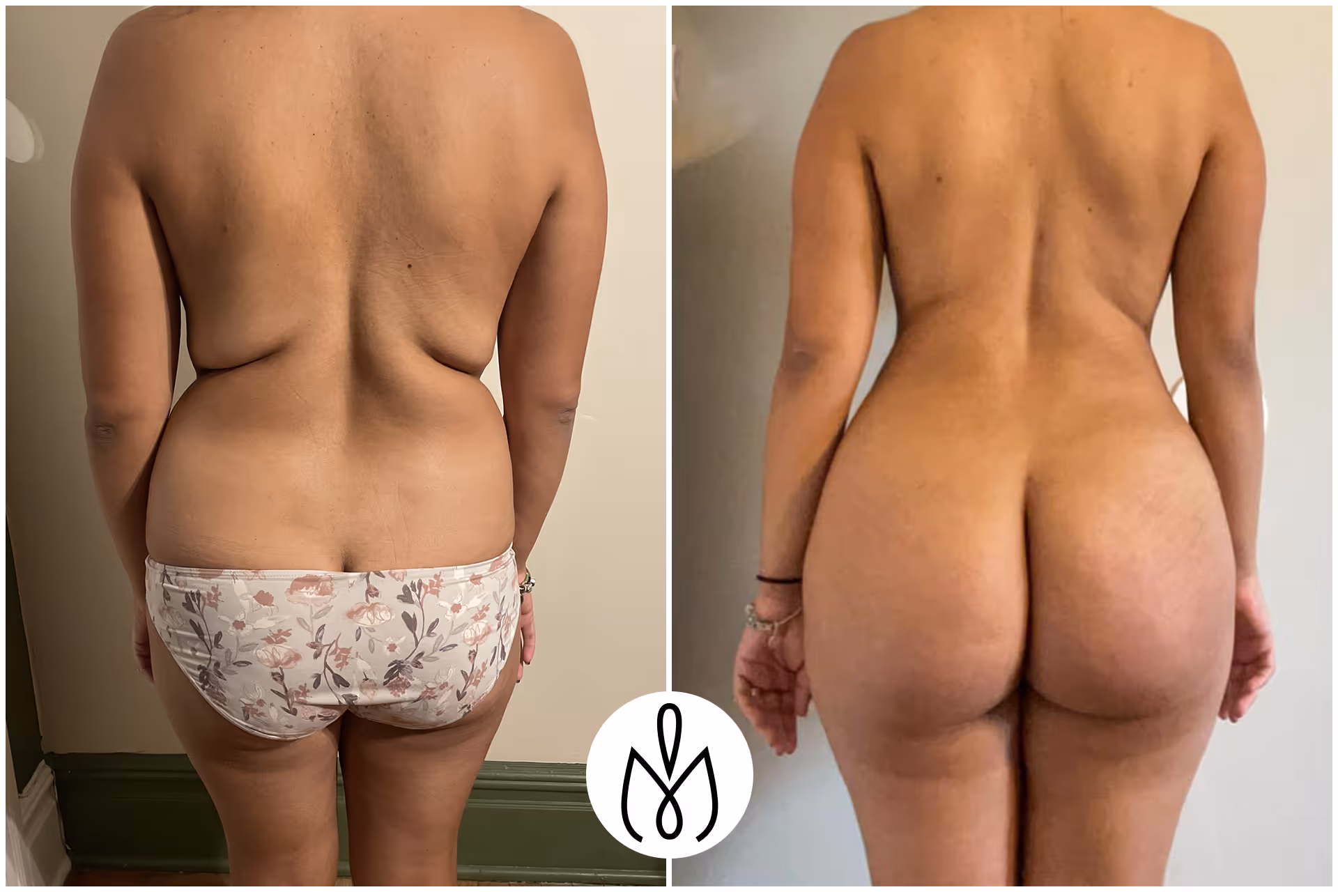 Before,After