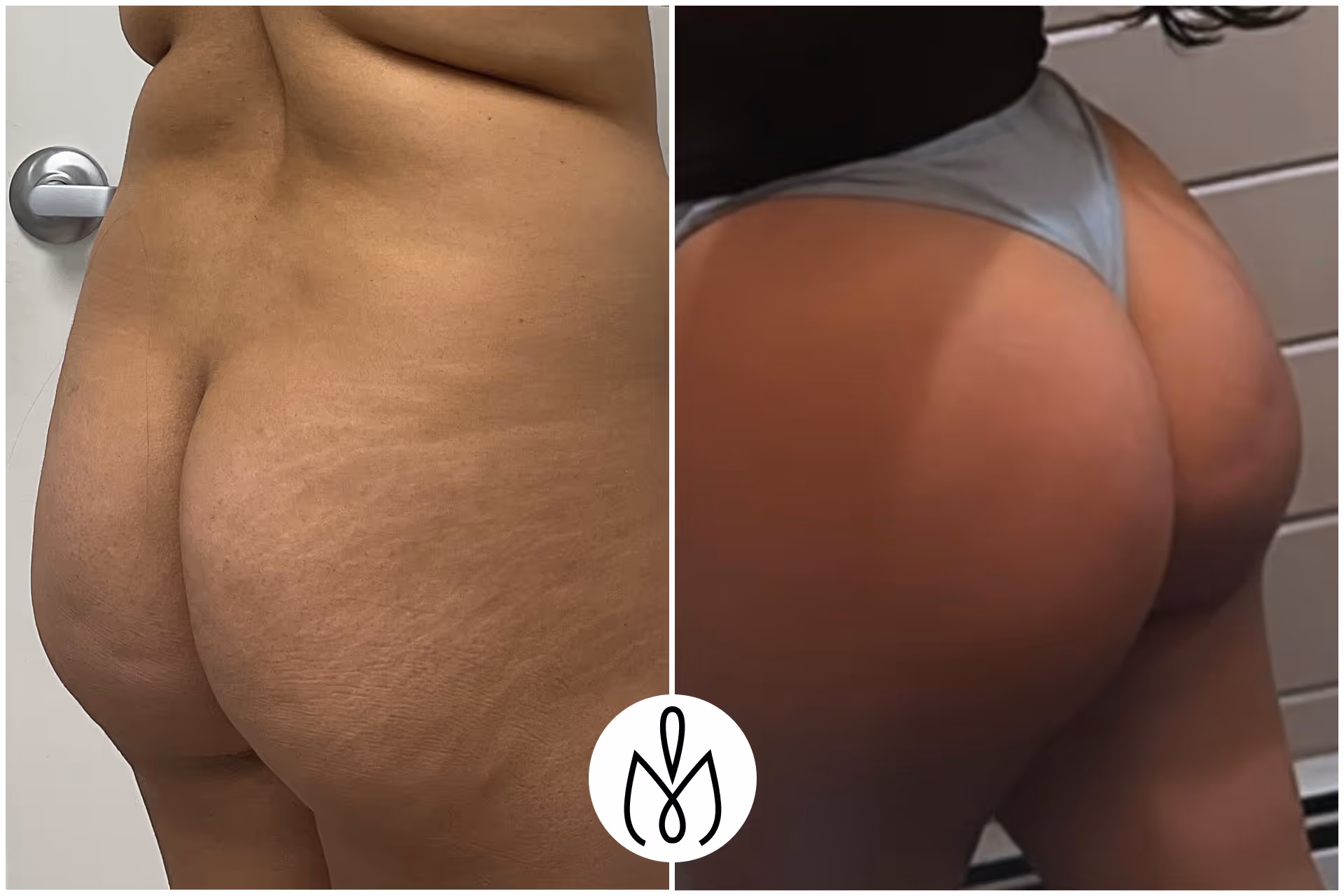 Before,After