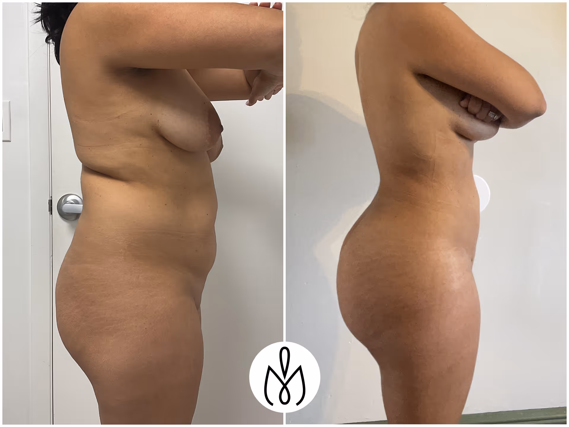 Before,After