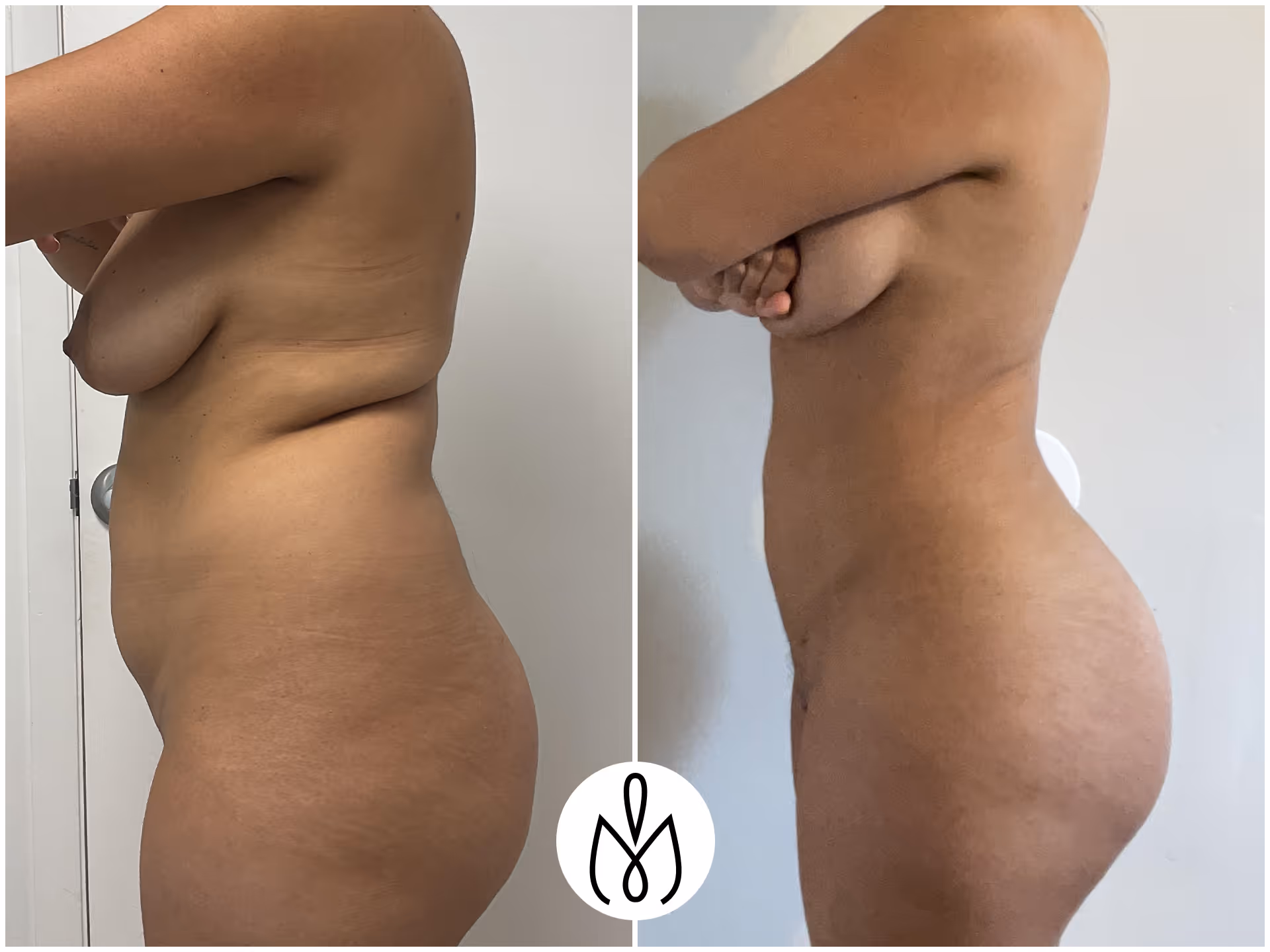 Before,After