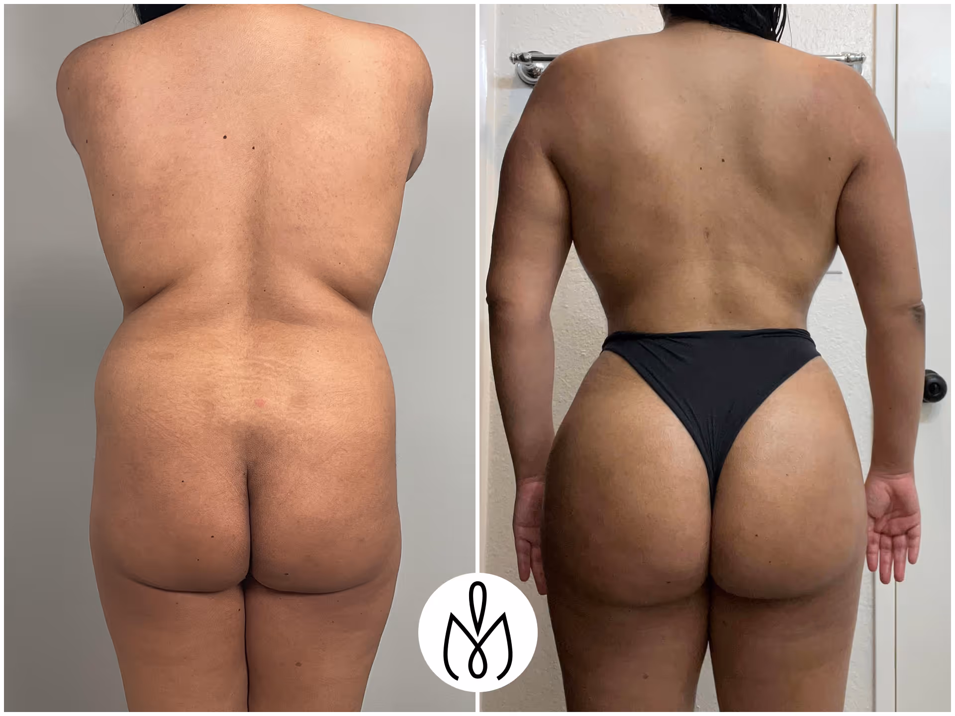 Before,After